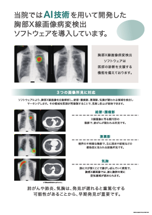 AI技術を用いた胸部レントゲン写真の病変検出ソフトウェアを導入しました