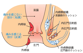 お尻の悩み 便秘 守口市のしみずファミリークリニック 痔の治療